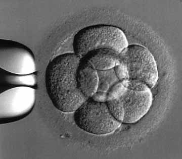 Crioconservazione embrioni