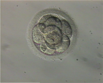 Aneuploidie embrionali
