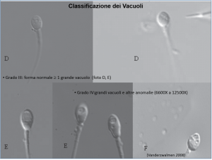 Classificazione dei Vacuoli